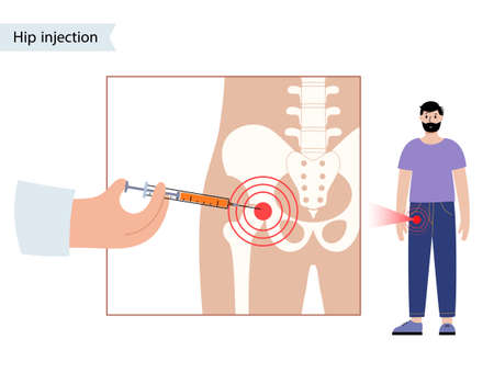 Understanding Preclinical Osteoporosis: Signs Before a Fracture Occurs